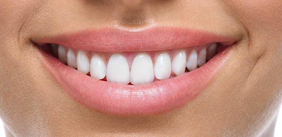 Andrew Baderski Dental - Tooth Whitening