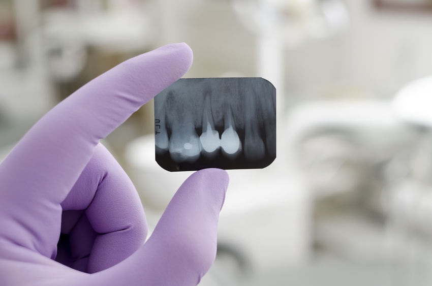 24584122 - doctor holding and looking at dental x-ray