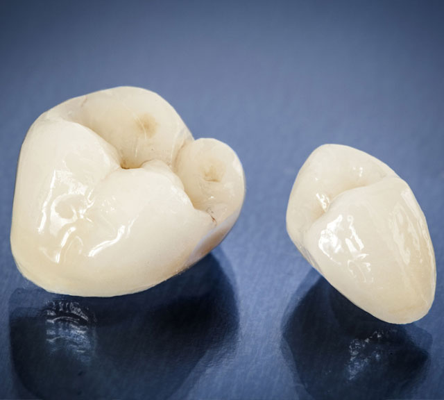 dental-crowns